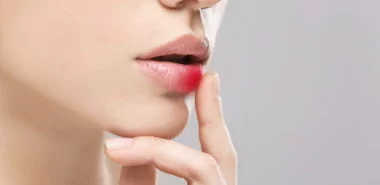 Lippenherpes Hausmittel: Was hilft gegen Fieberbläschen an der Lippe?